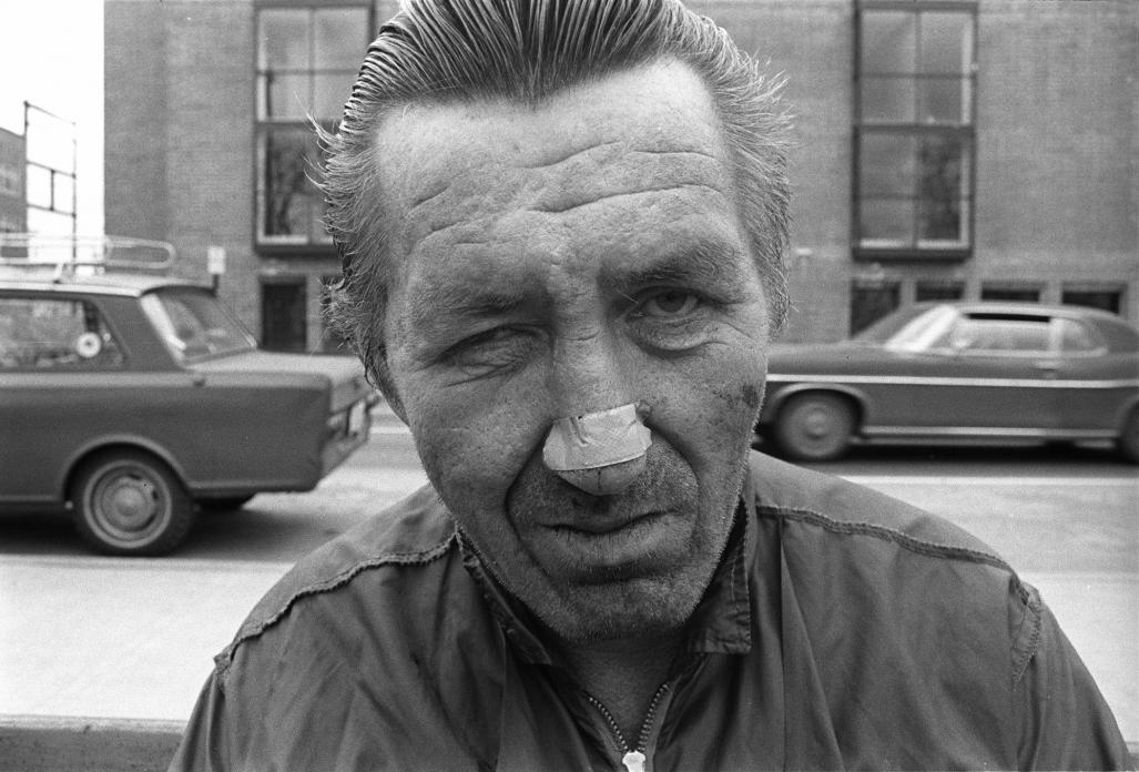 Man with Bandaid on Nose. 1974